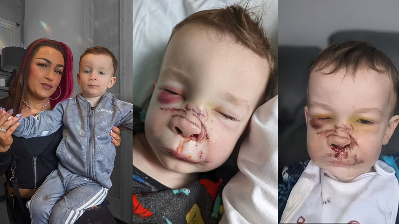 Mother posts heartbreaking photos of her 2-year-old son